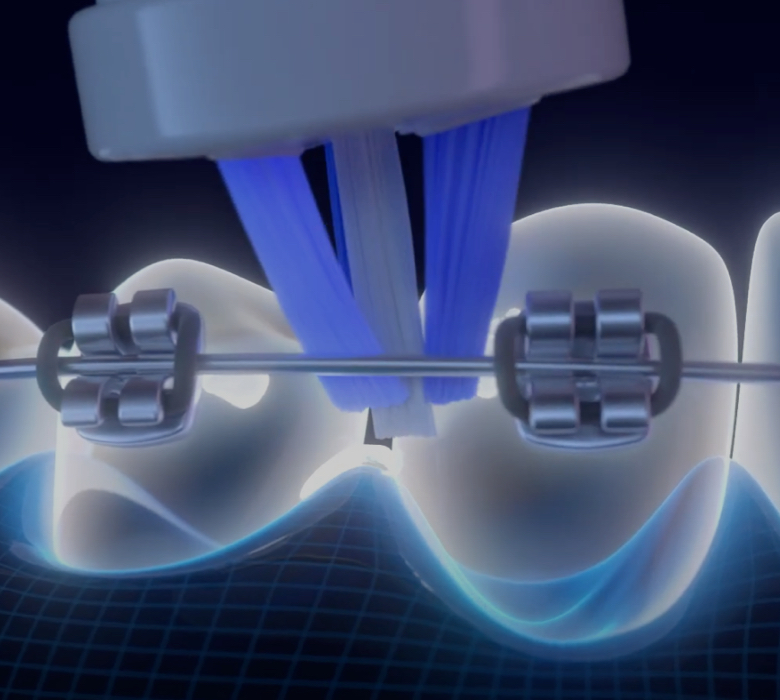 braces-how-to-brush-video-background-image