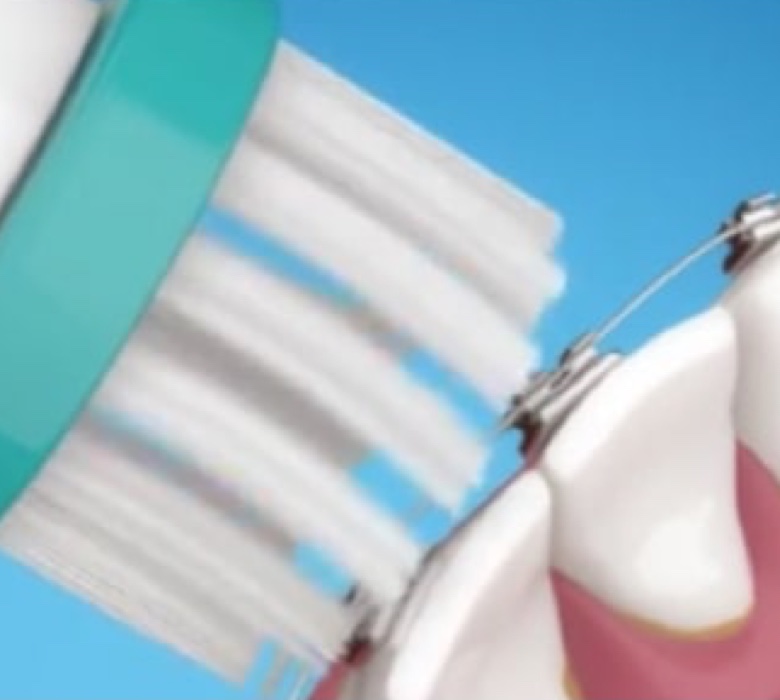 how-to-brush-and-floss-with-braces-background-image