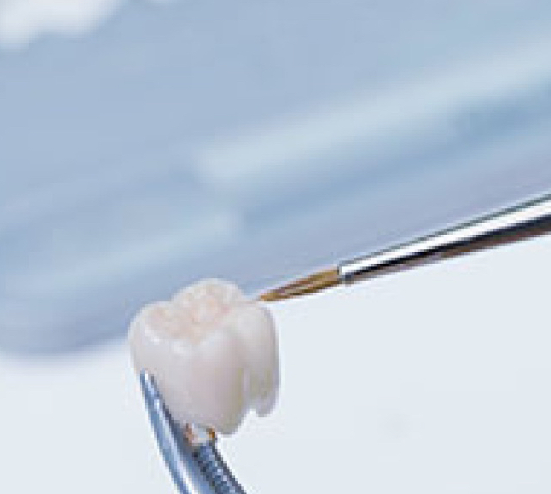 what-is-a-dental-crown-article-background-image