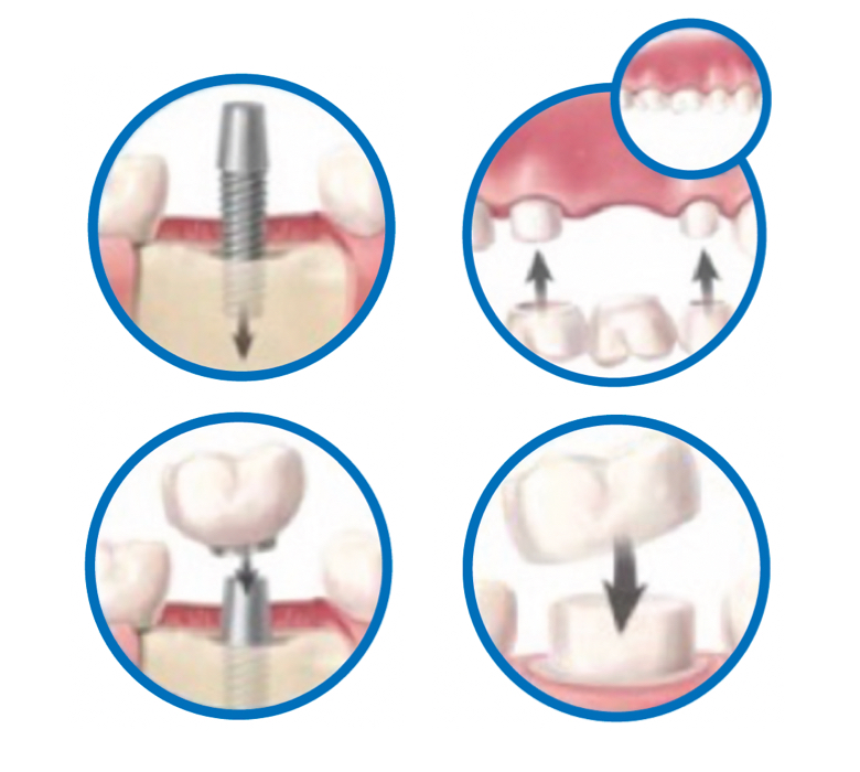 restorative-dentistry-background-image