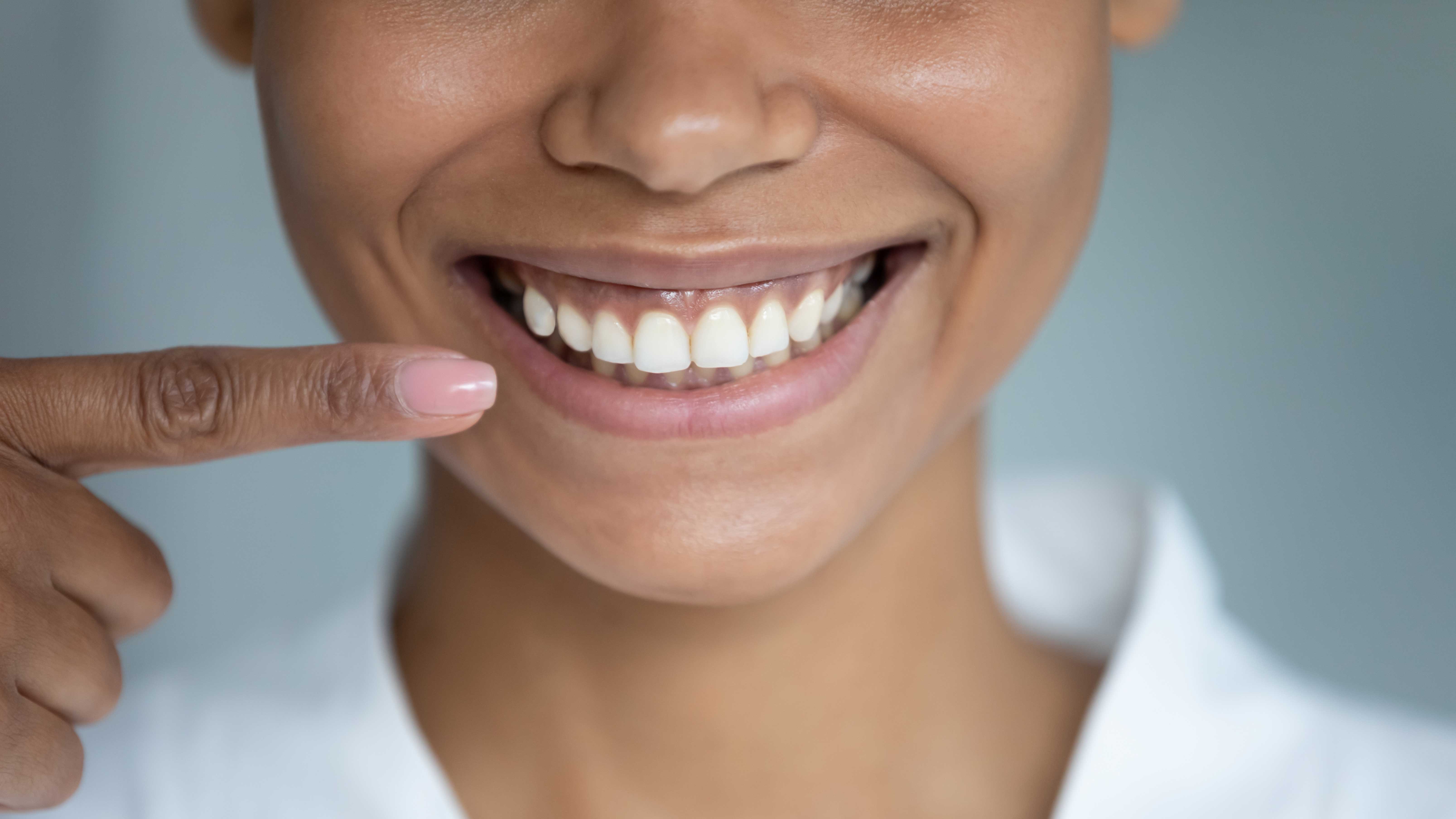 Smiling woman showing off her healthy gums