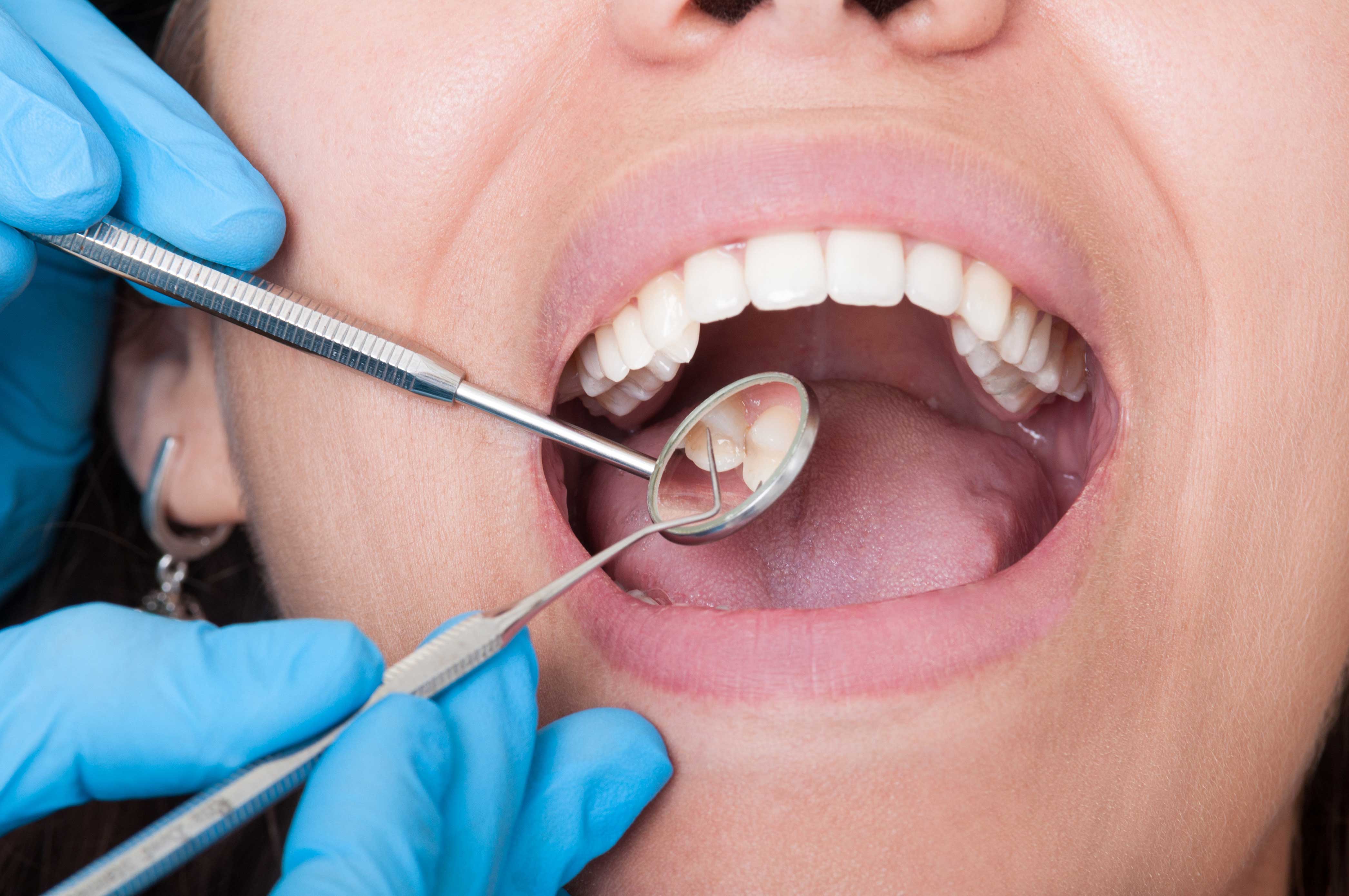 Dentist examining young woman’s mouth