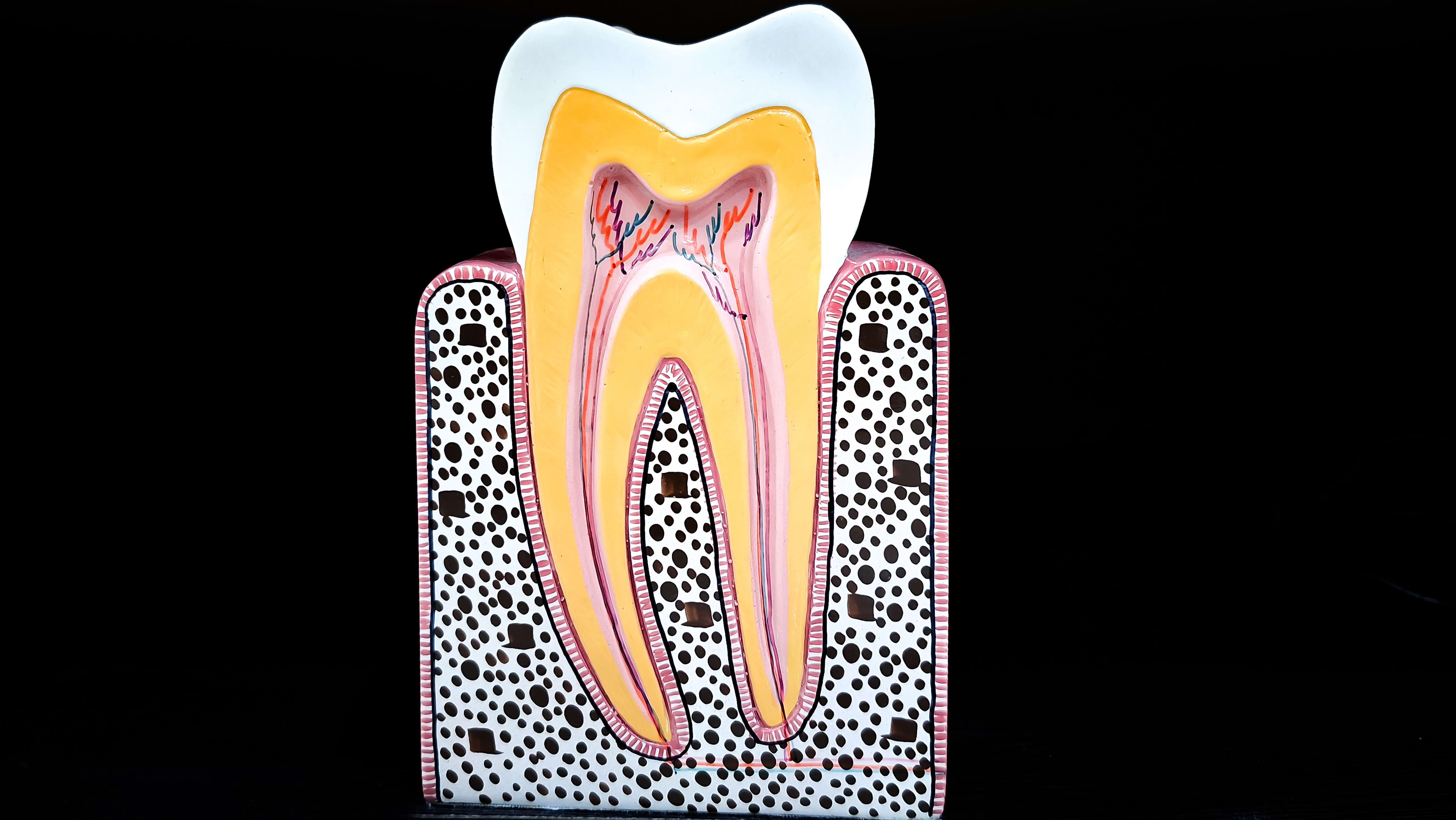 Cross section of tooth showing enamel, dentin, and pulp