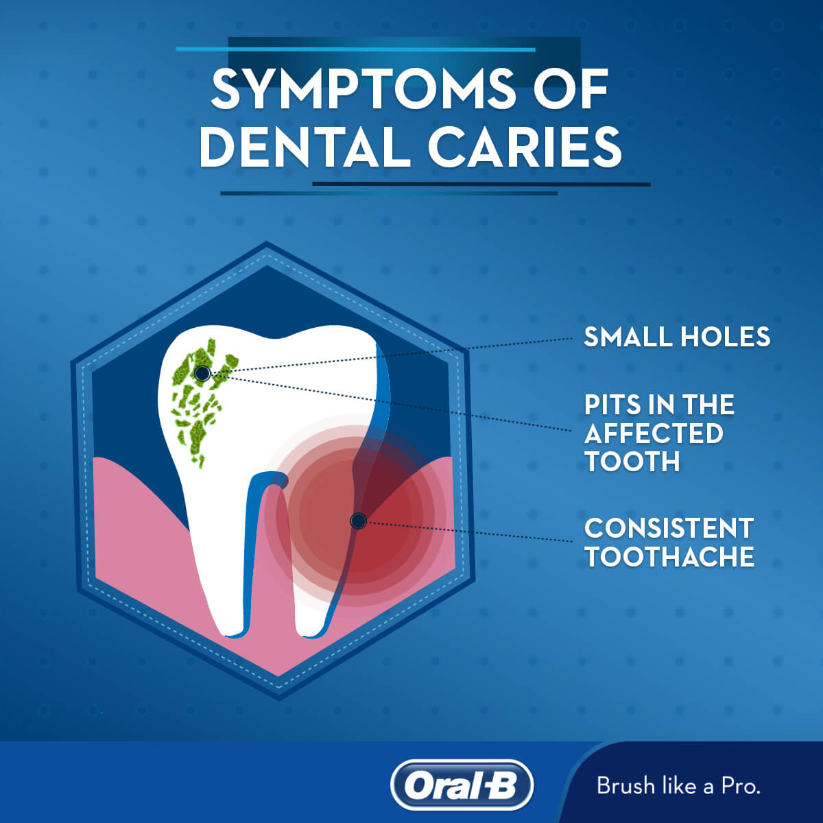 dental-caries