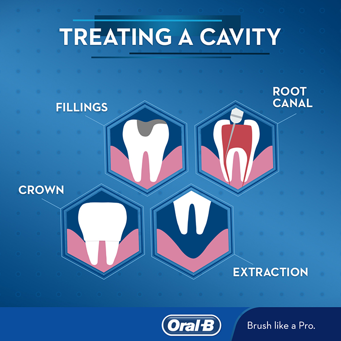 infographic-cavity-700