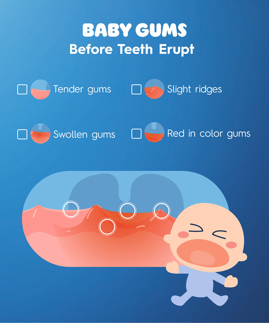 Baby's gums before teething: tender, swollen, red, and slight ridges.