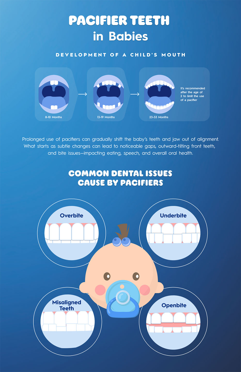 Pacifier teeth in babies