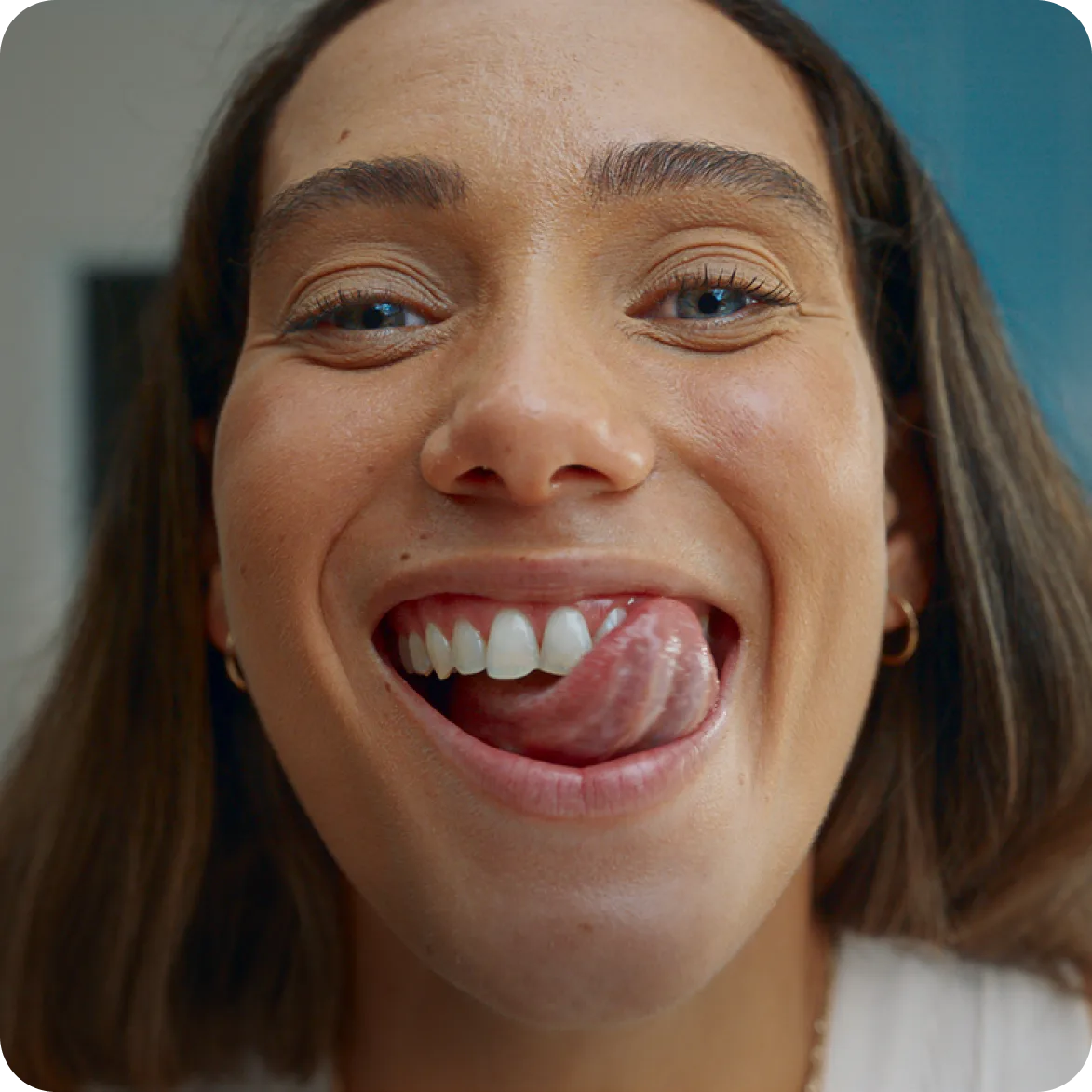 Whiter teeth