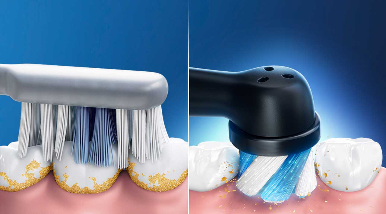 Electric toothbrush vs. manual toothbrush visual comparison, showing superior cleaning efficacy of electric toothbrush