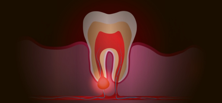 Illustration of cross section of a tooth