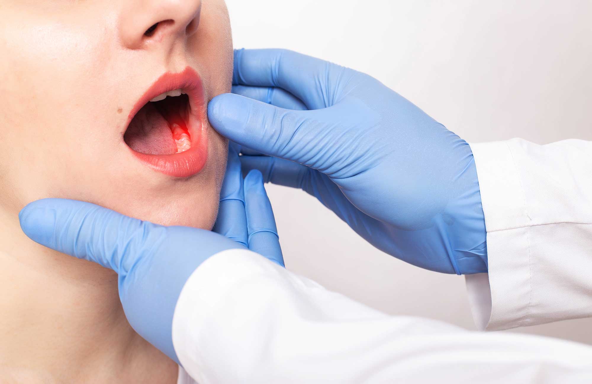 Dental professional examining a patient’s abscessed tooth