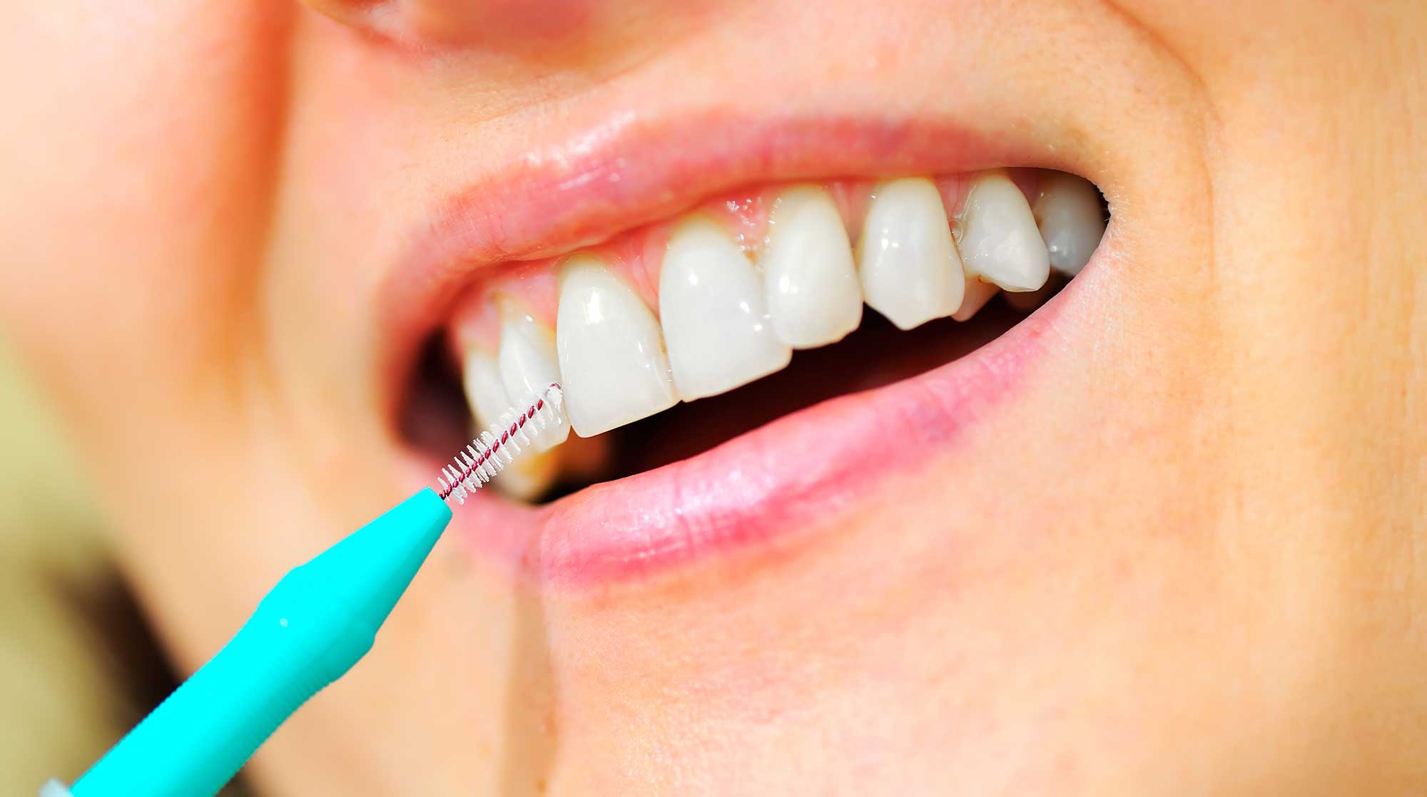 Close-up of a person flossing with a small interdental brush