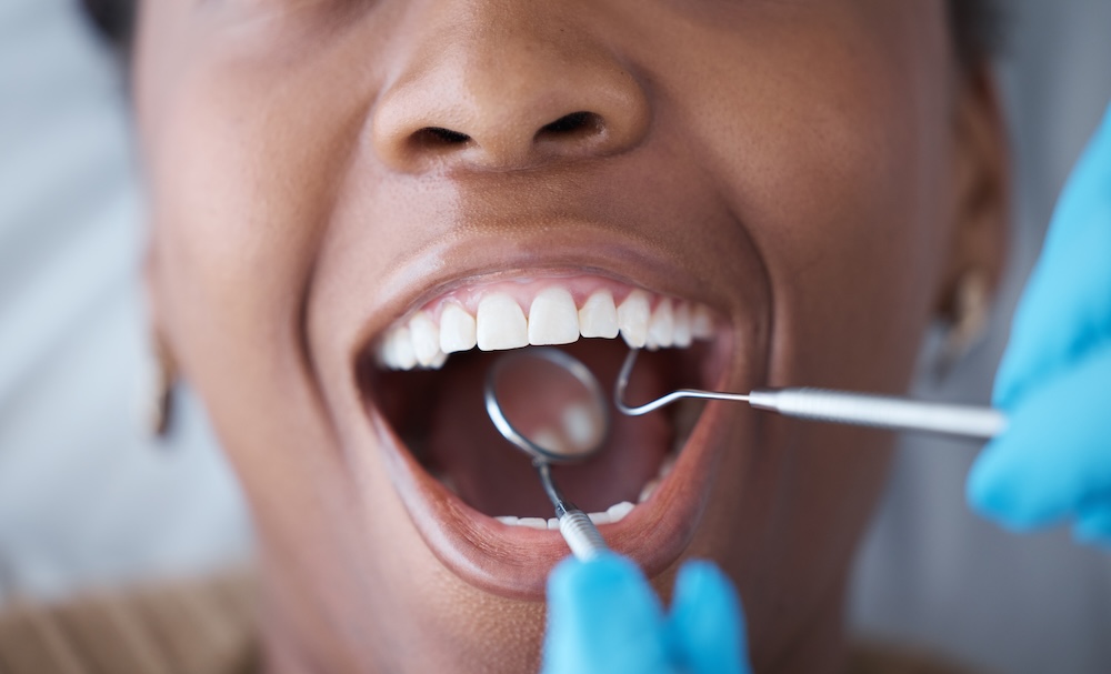 Close-up of patient receiving dental treatment