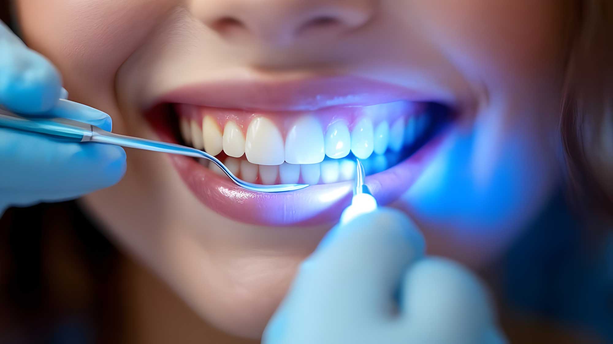 Close-up of someone getting their teeth probed by gloved hands