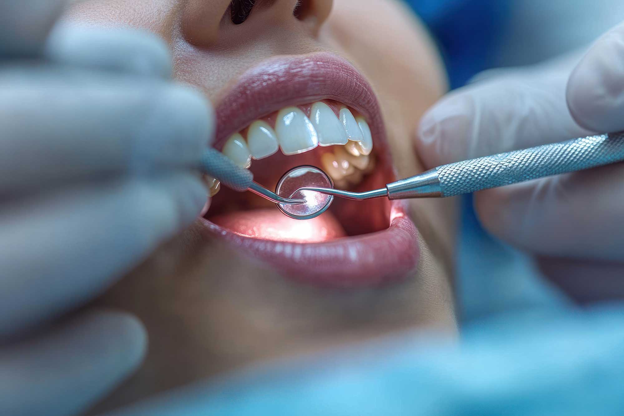 Close-up of teeth being examined in a dentist’s office