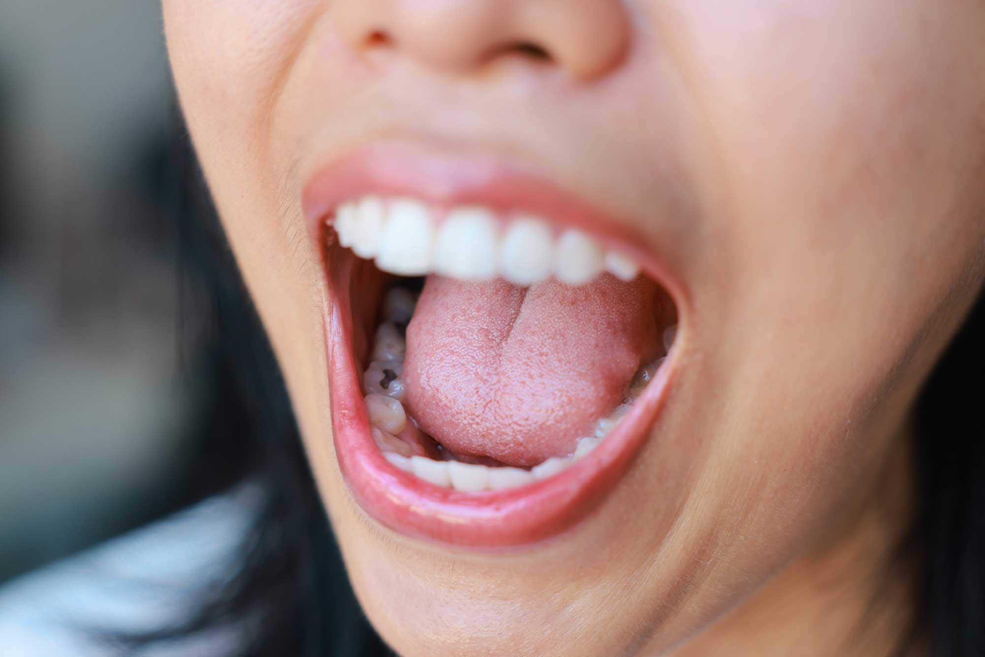 Close-up pf a person with their mouth wide open showing teeth and tongue