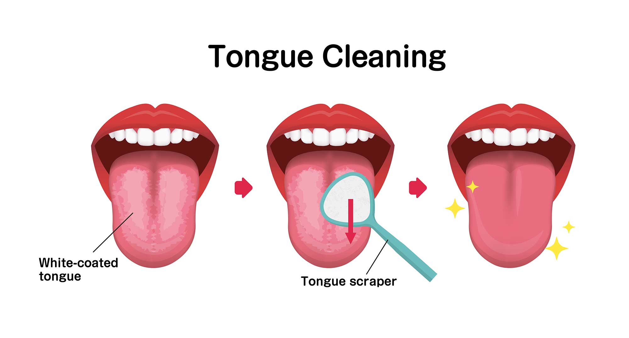 How-to guide showing three steps to tongue scraping