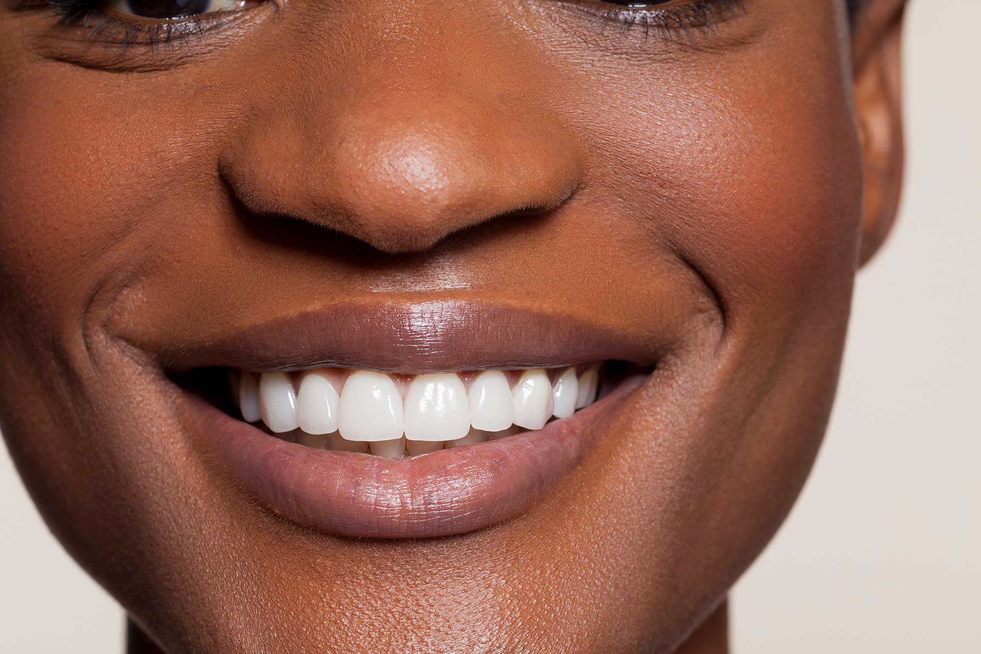 Close-up of a smiling woman showing her healthy, white teeth