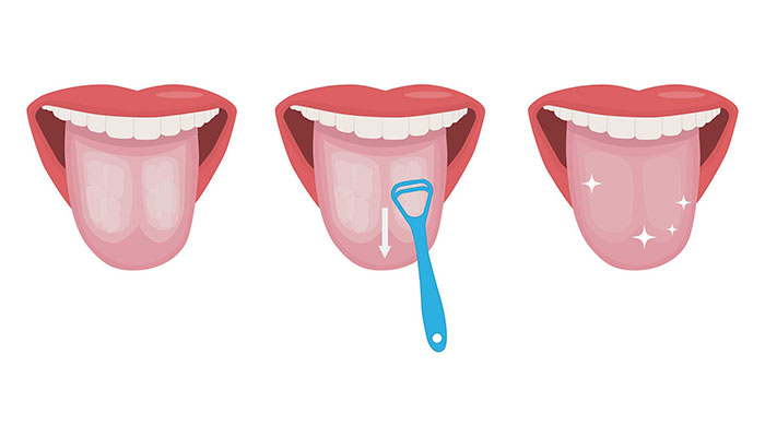 How-to guide showing three steps to tongue scraping How-to guide showing three steps to tongue scraping