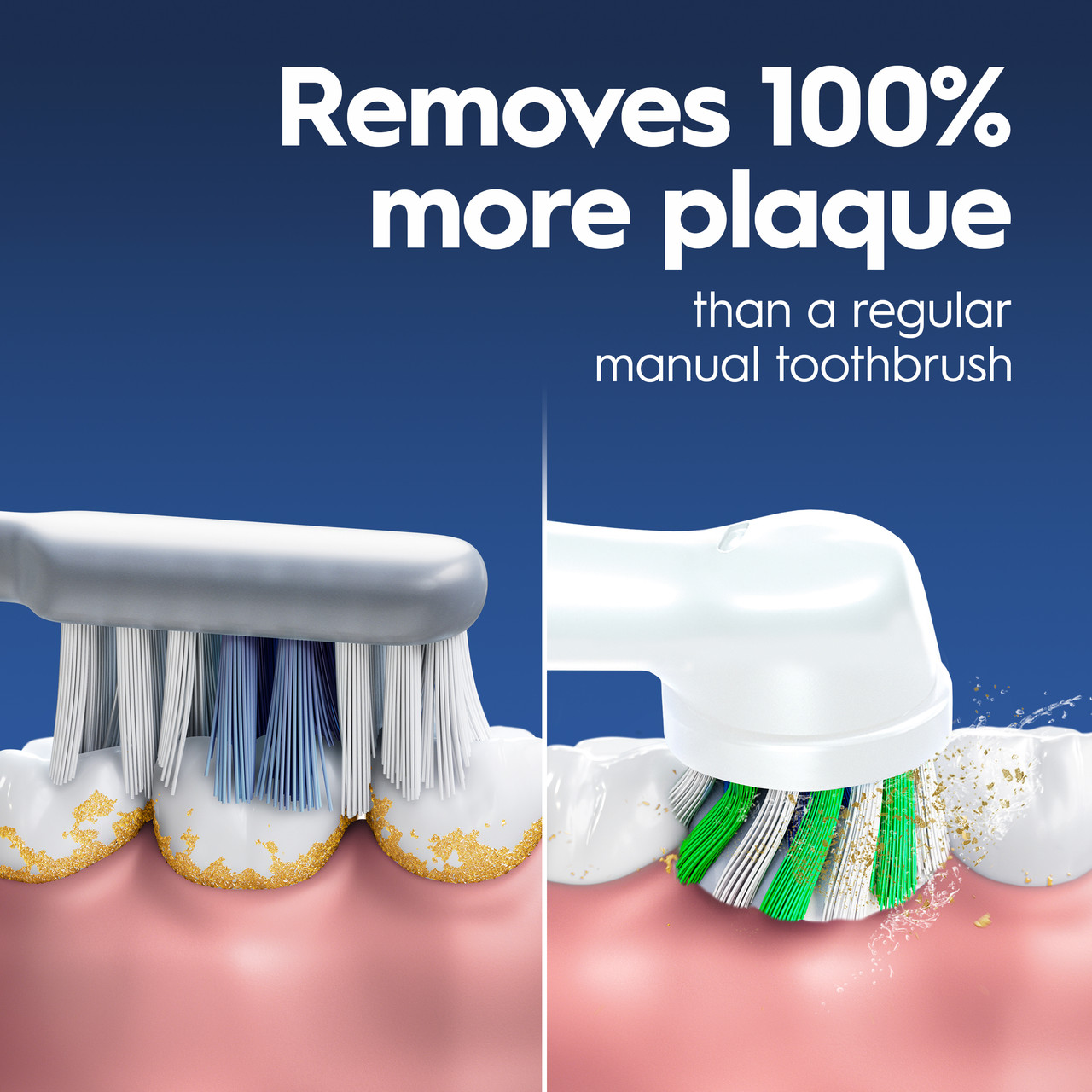 Genius X Limited Electric Toothbrush | Oral-B
