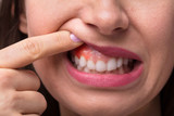 Gum Pain: Causes, Symptoms, and Treatments