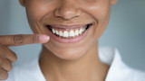 What Do Healthy Gums Look Like?