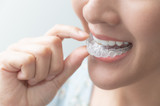 Retainers After Braces: Use & Cleaning Guidelines