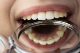 Permanent Retainer: Benefits, Care, And What To Expect