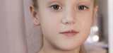 Cold Sores in Toddler: Causes, Symptoms, and Prevention