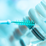 How to Clean Your Dental Implants