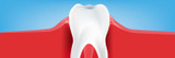What is Gingivitis? Symptoms, Causes, and Treatments