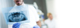 Dental X-Rays: How They Work & When to Get Them