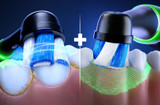 How Oral-B iO Electric Toothbrush Supports Healthier Gums