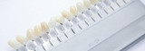 Dental Veneers - What to Expect