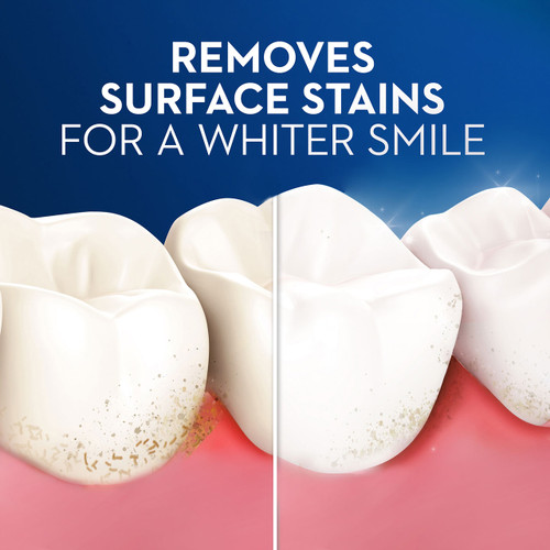 Pulsar Battery Toothbrush with Charcoal Infused Bristles OralB