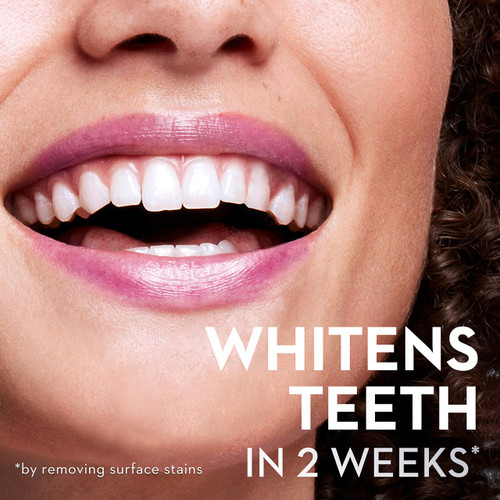 Pulsar Battery Toothbrush with Charcoal Infused Bristles OralB