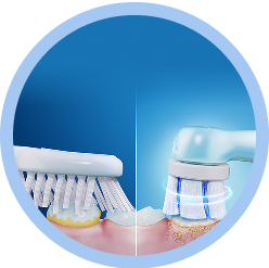 Side-by-side of manual toothbrush vs. Oral-B’s electric toothbrush