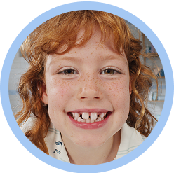 Redheaded kid smiling, showing teeth