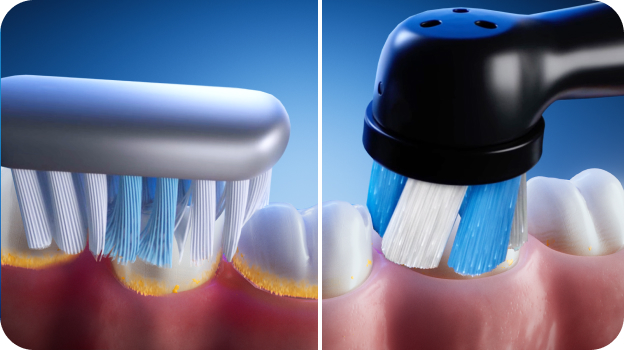 Why Oral-B