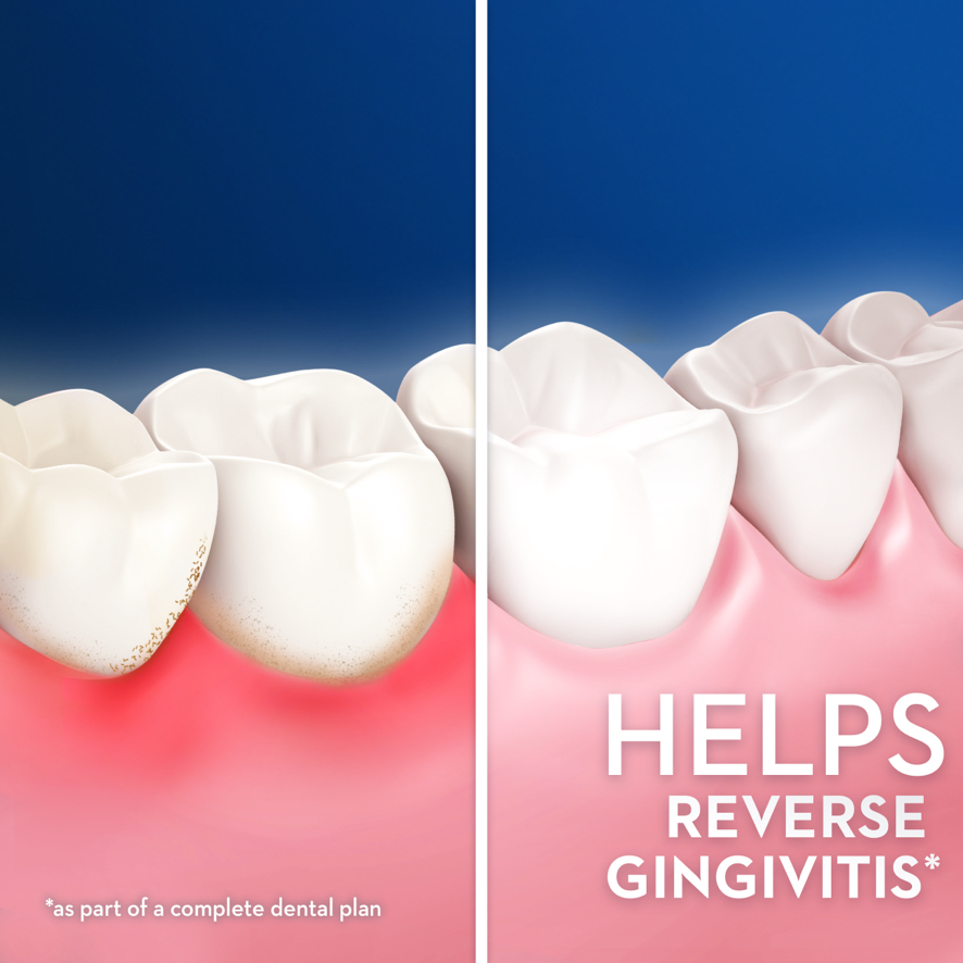 bleeding-gums-pop-up-image