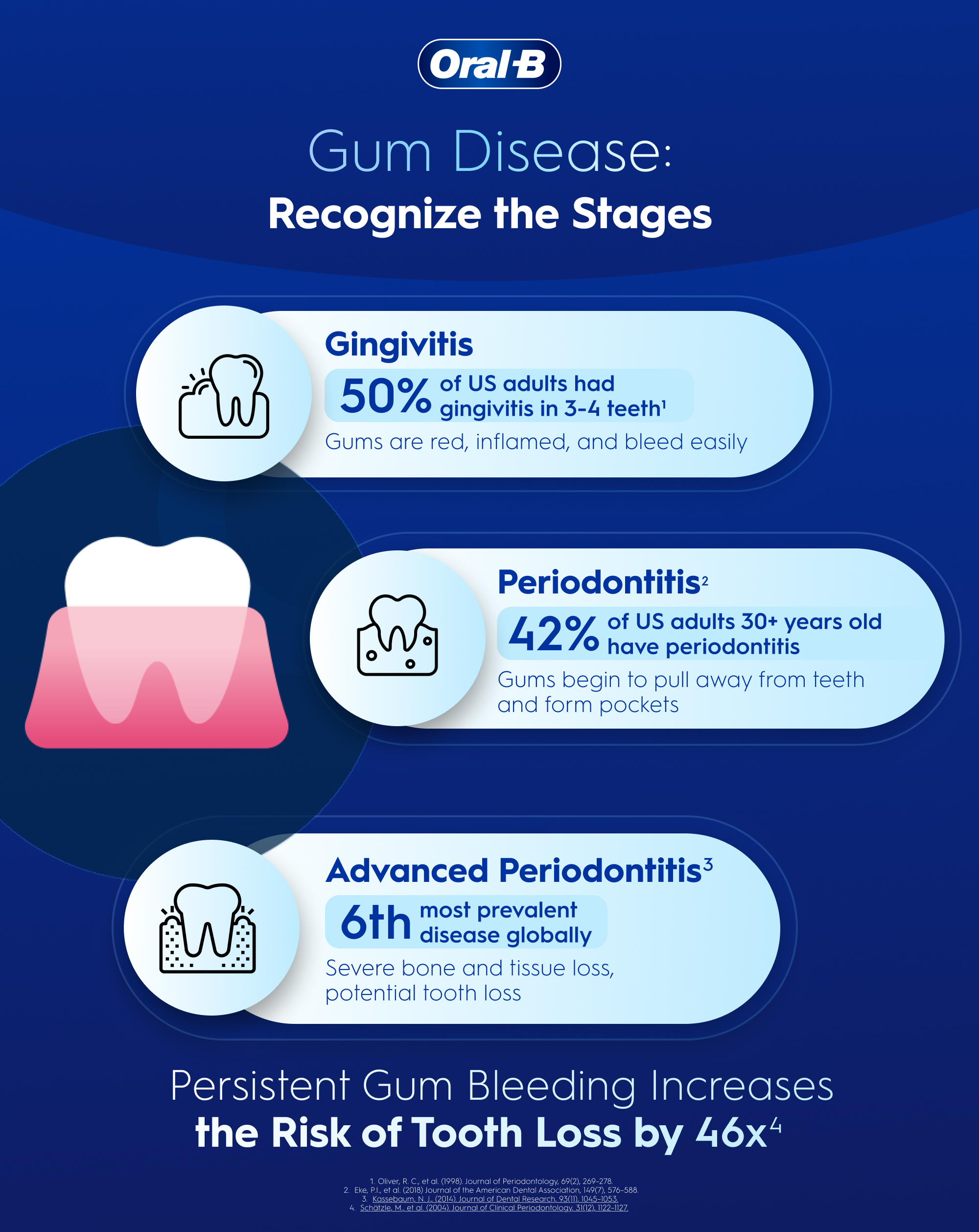 Gum Disease: Recognize the Stages Stages of gum disease beginning with Gingivitis, Periodontitis, and Advanced Periodontitis, and a fact about gum bleeding increasing tooth loss risk.