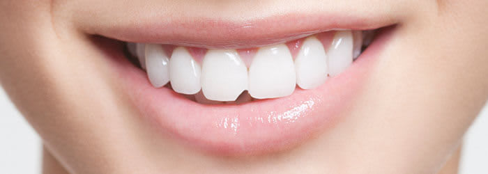 Chipped Tooth Repair with Chipped Tooth Bonding - Oral-B