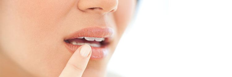 Cold Sores: Causes, Symptoms, & Treatments