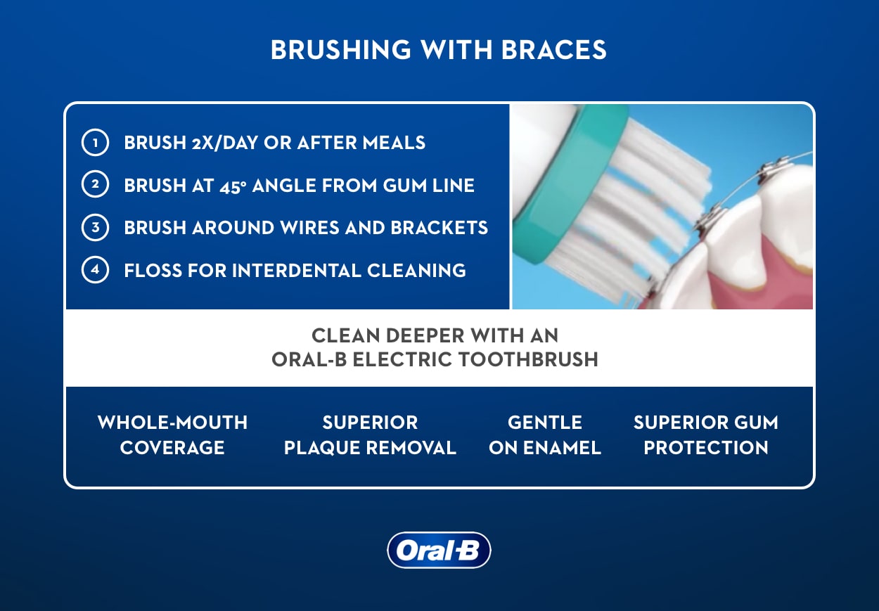 How long should you brush your teeth? Here are some tips from experts