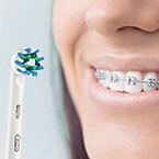 https://cdn11.bigcommerce.com/s-2idmiil7bp/product_images/uploaded_images/how-to-brush-your-teeth-and-floss-with-braces-145x147.jpg