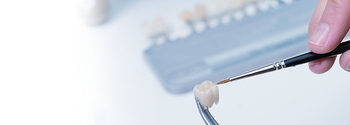 Dental Crowns: How Teeth Crowns Work Banner Image Dental Crowns: How Teeth Crowns Work