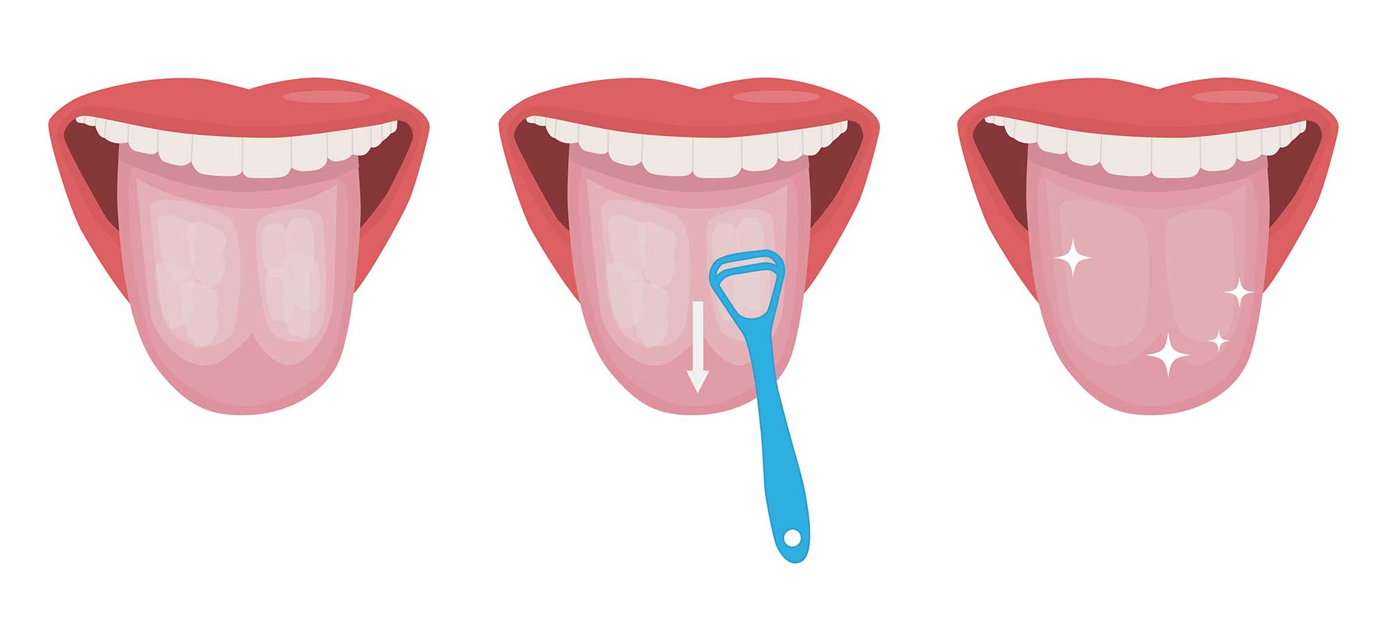 How-to guide showing three steps to tongue scraping