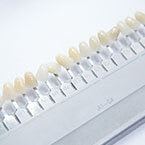 Dental Veneers