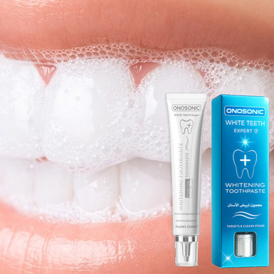 How to Whiten Sensitive Teeth at Home: The Ultimate Guide