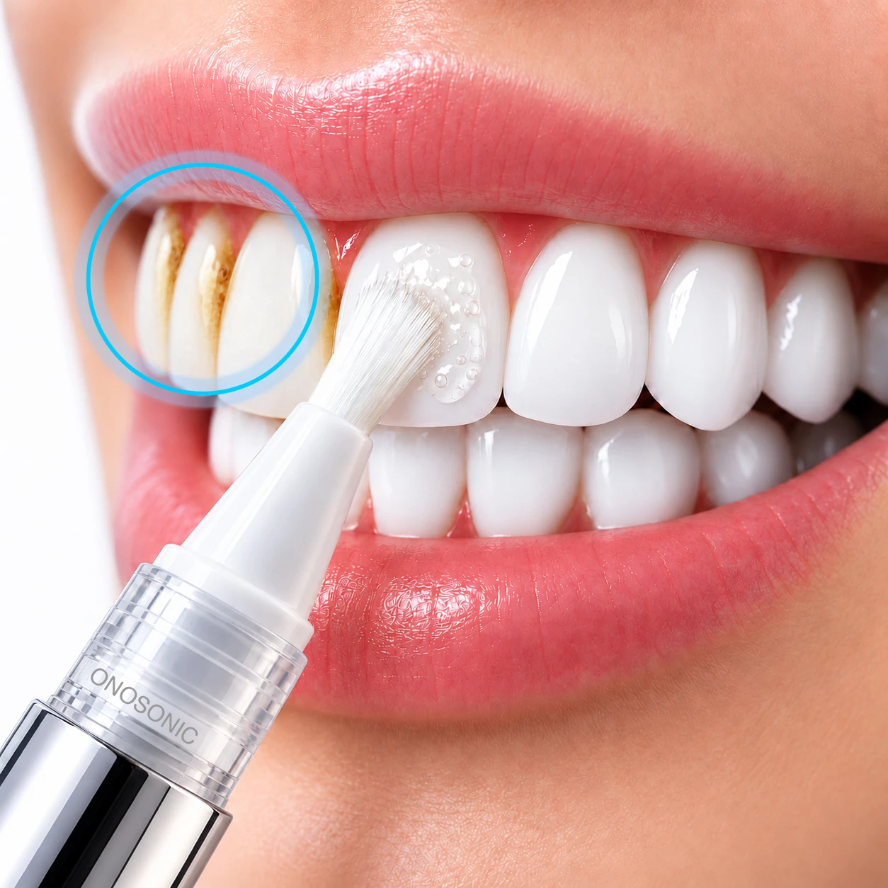 ONOSONIC Teeth Whitening Gel Pen Pro with precision brush applicator for targeted yellow teeth whitening Dubai UAE, alternative to Crest 3D White and Colgate Optic White products | قلم تبييض الأسنان أونوسونيك بفرشاة دقيقة لإزالة تصبغات الأسنان في دبي والإمارات